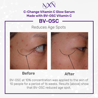 NxN Vitamin C & Hyaluronic Acid Serum Set